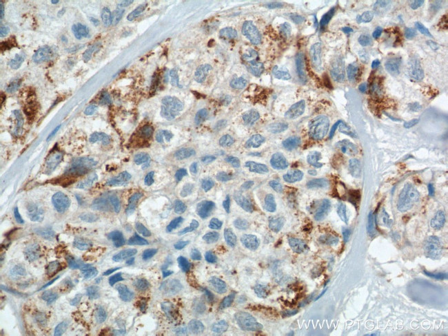 COX2 Antibody in Immunohistochemistry (Paraffin) (IHC (P))