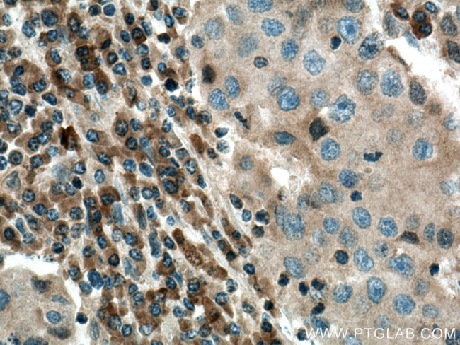 COX2 Antibody in Immunohistochemistry (Paraffin) (IHC (P))