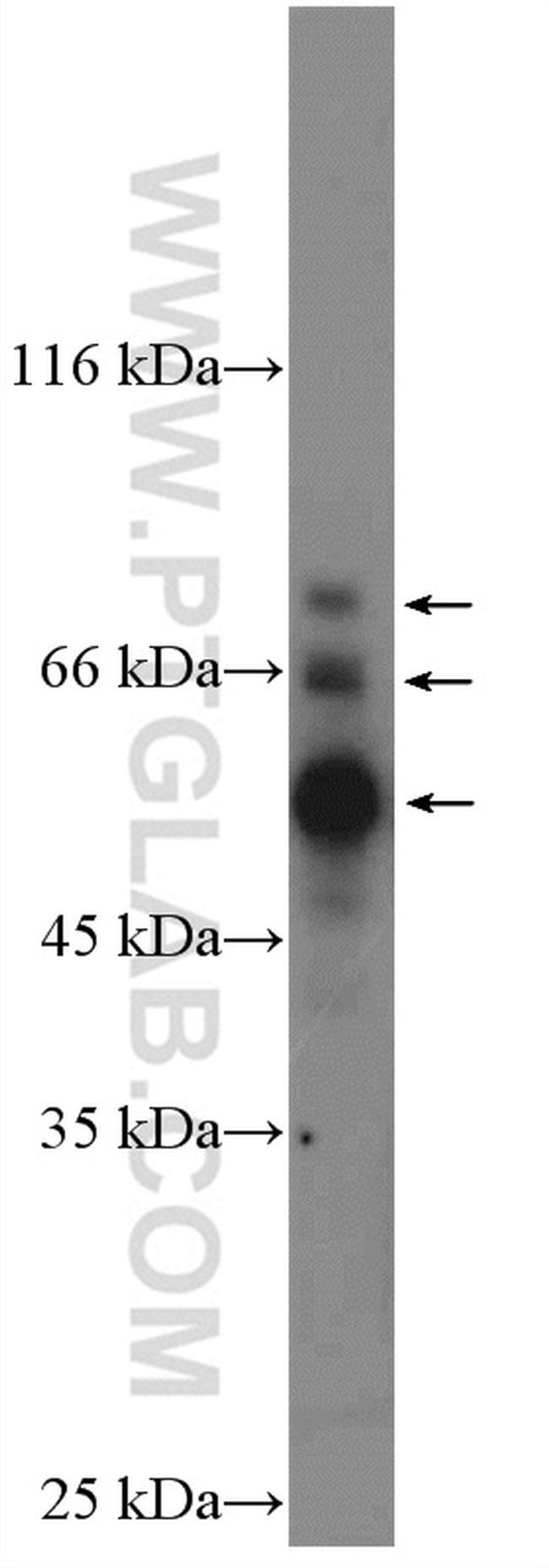 COX2 Antibody in Western Blot (WB)