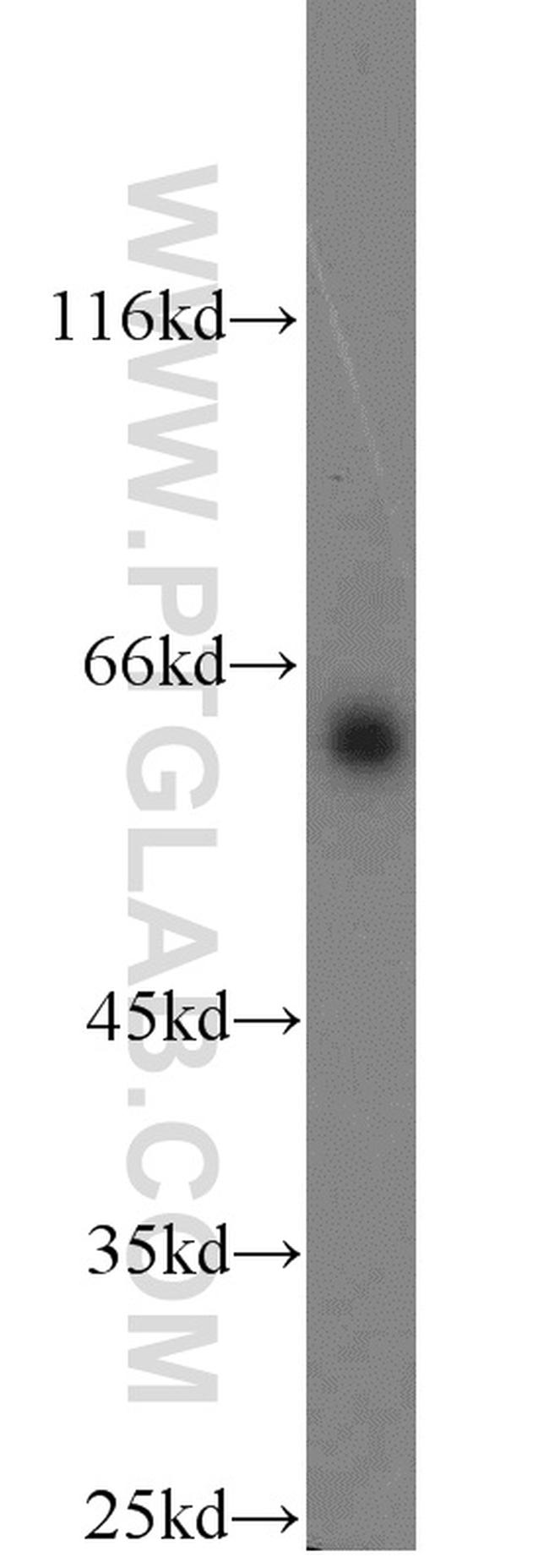 COX2 Antibody in Western Blot (WB)