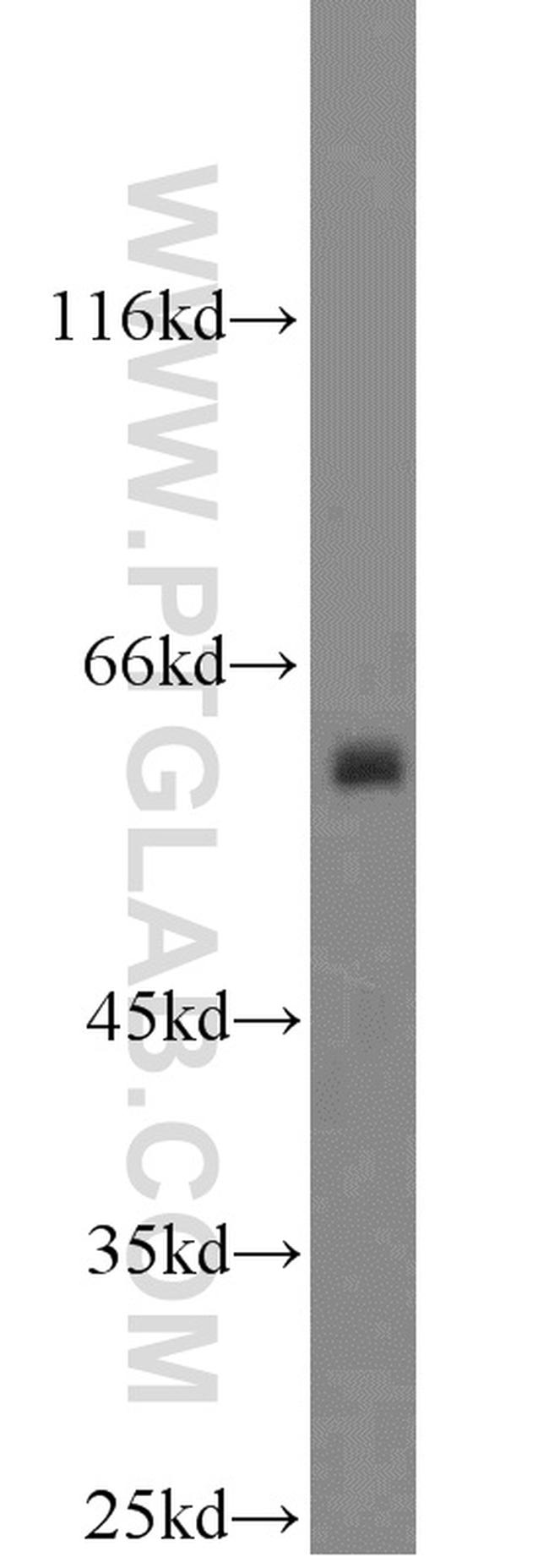 COX2 Antibody in Western Blot (WB)