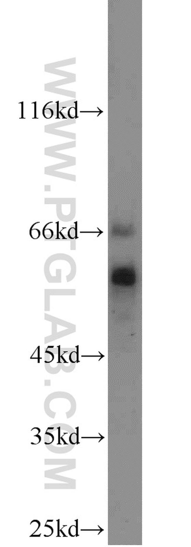 COX2 Antibody in Western Blot (WB)