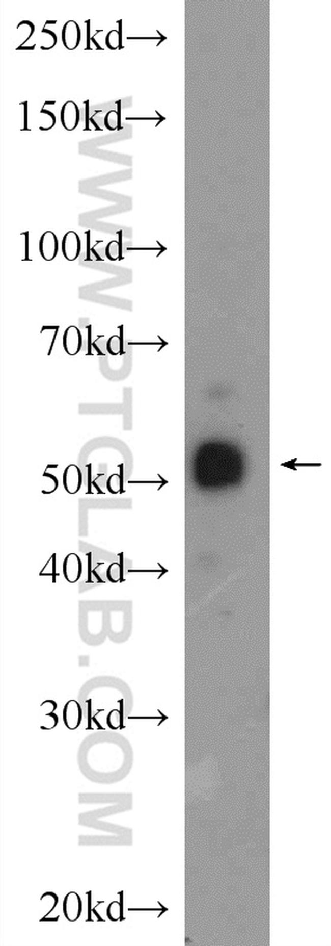 COX2 Antibody in Western Blot (WB)