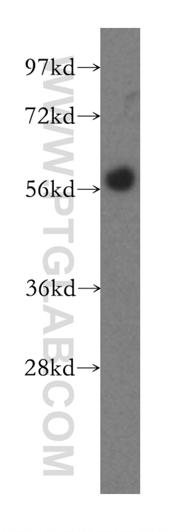 GPR183/EBI2 Antibody in Western Blot (WB)