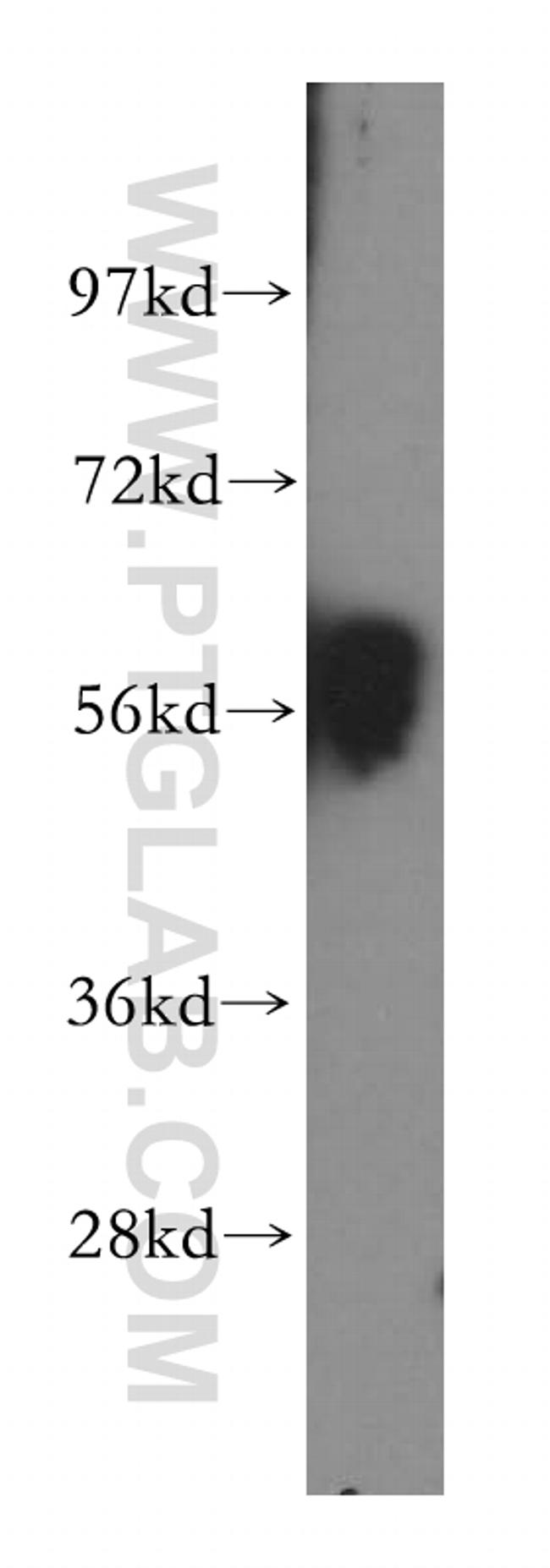 GPR183/EBI2 Antibody in Western Blot (WB)