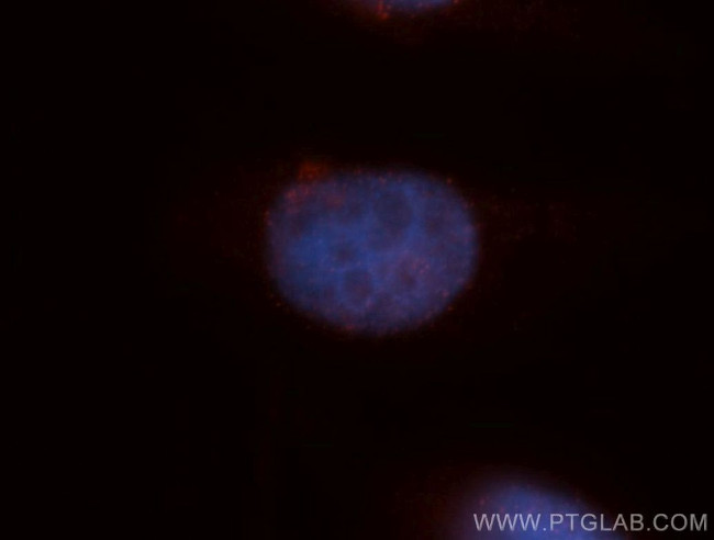 HDGFRP3 Antibody in Immunocytochemistry (ICC/IF)