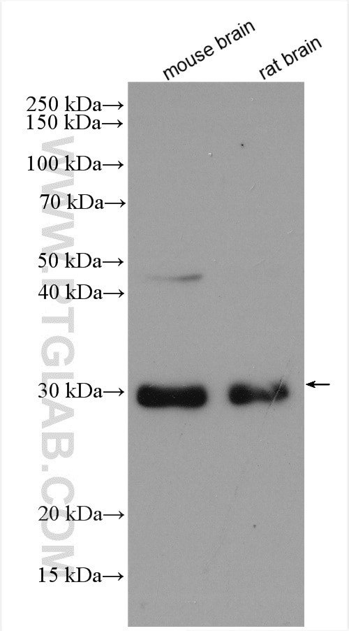 HDGFRP3 Antibody in Western Blot (WB)