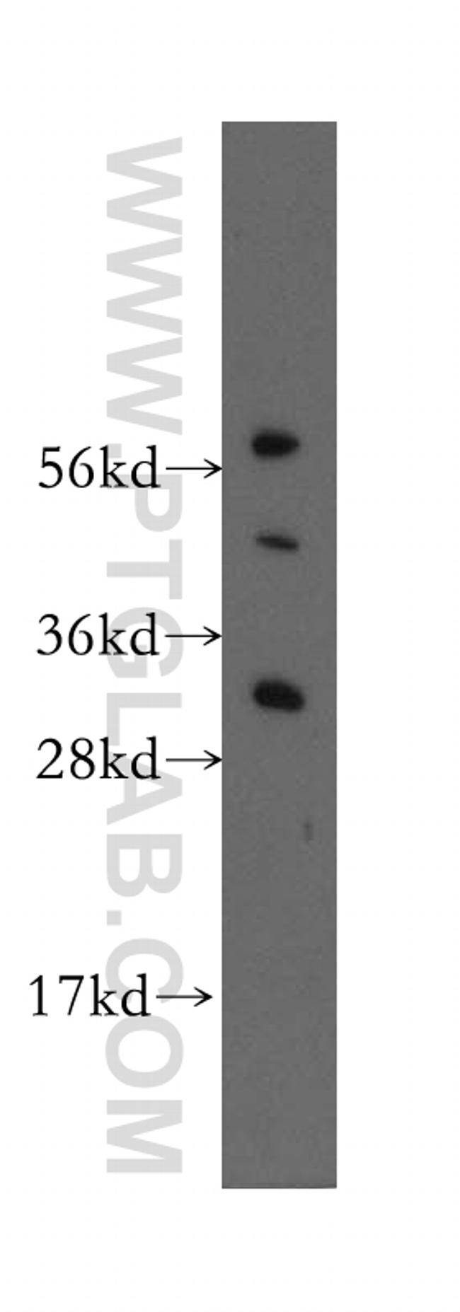 HDGFRP3 Antibody in Western Blot (WB)