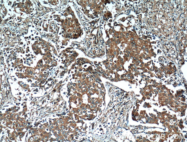 14-3-3 gamma Antibody in Immunohistochemistry (Paraffin) (IHC (P))