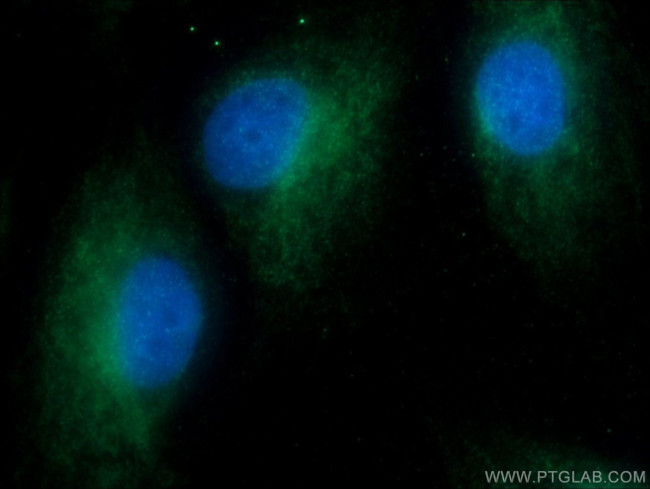 14-3-3 gamma Antibody in Immunocytochemistry (ICC/IF)