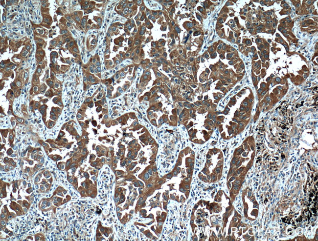 14-3-3 gamma Antibody in Immunohistochemistry (Paraffin) (IHC (P))