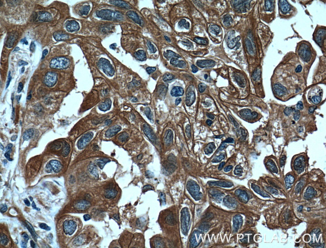 14-3-3 gamma Antibody in Immunohistochemistry (Paraffin) (IHC (P))