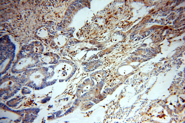 PD-ECGF Antibody in Immunohistochemistry (Paraffin) (IHC (P))