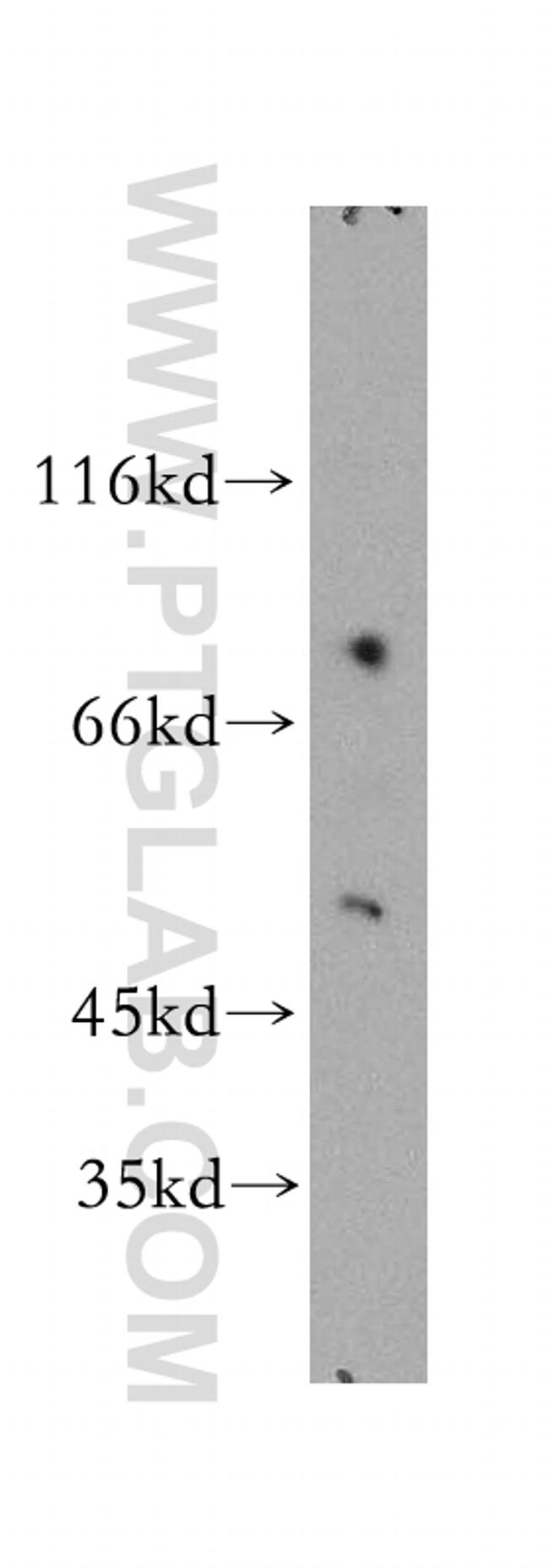 PD-ECGF Antibody in Western Blot (WB)