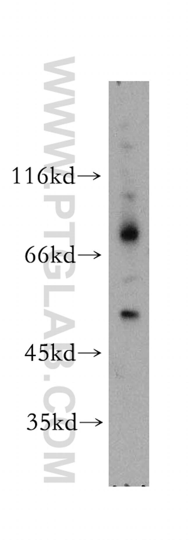 PD-ECGF Antibody in Western Blot (WB)