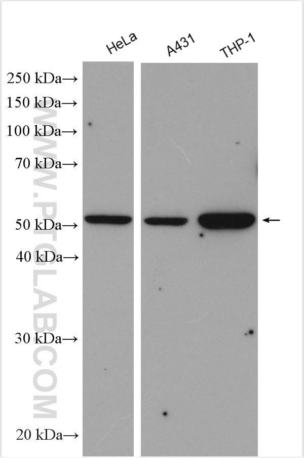 PD-ECGF Antibody in Western Blot (WB)