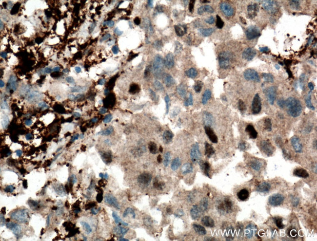 PD-ECGF Antibody in Immunohistochemistry (Paraffin) (IHC (P))