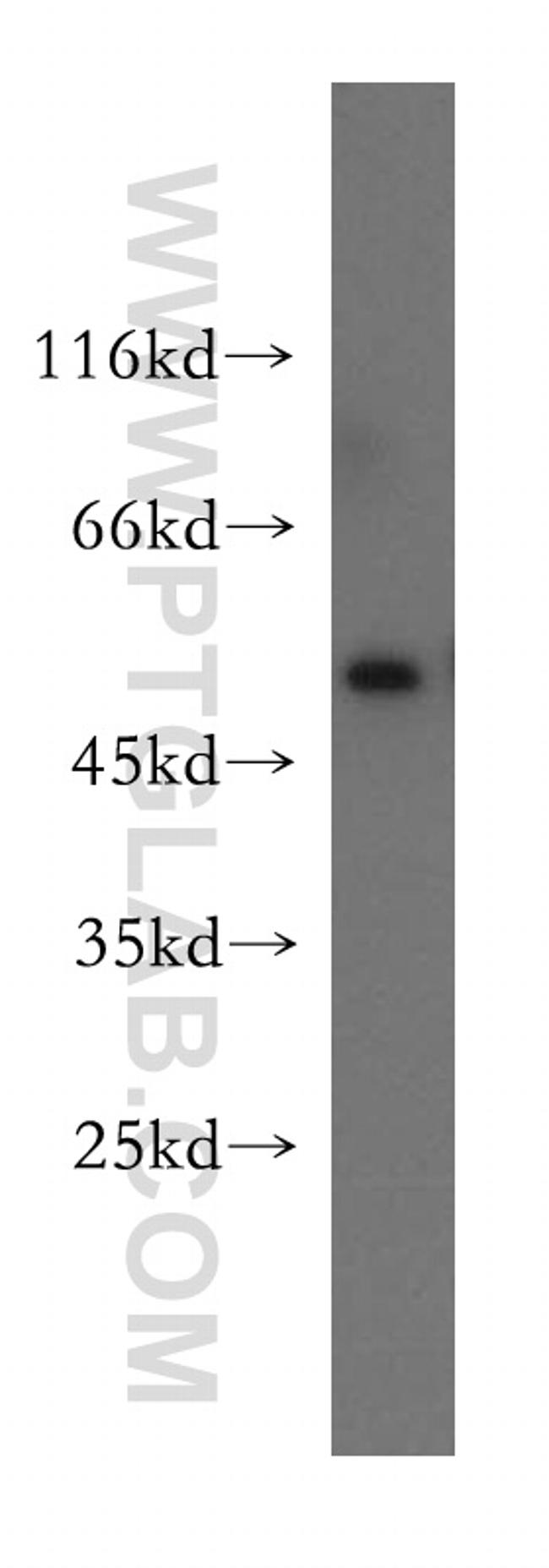 PD-ECGF Antibody in Western Blot (WB)