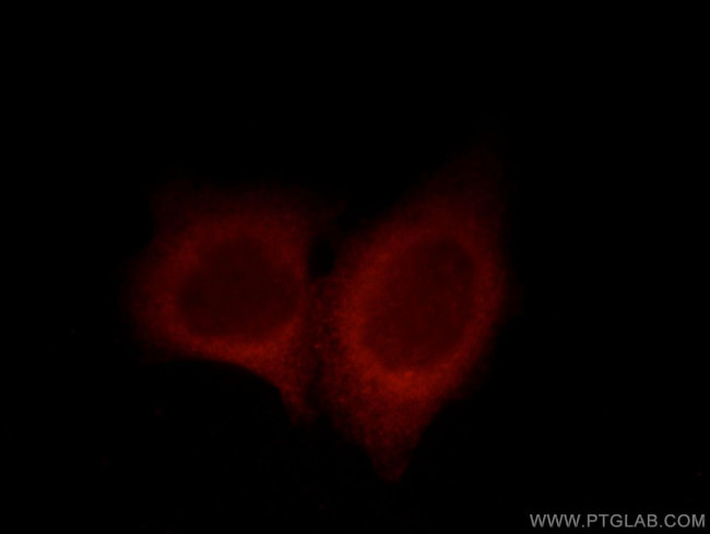 UBAP1 Antibody in Immunocytochemistry (ICC/IF)