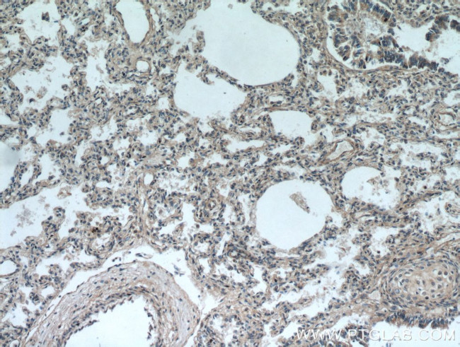 UBAP1 Antibody in Immunohistochemistry (Paraffin) (IHC (P))