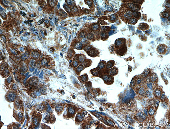 UBAP1 Antibody in Immunohistochemistry (Paraffin) (IHC (P))