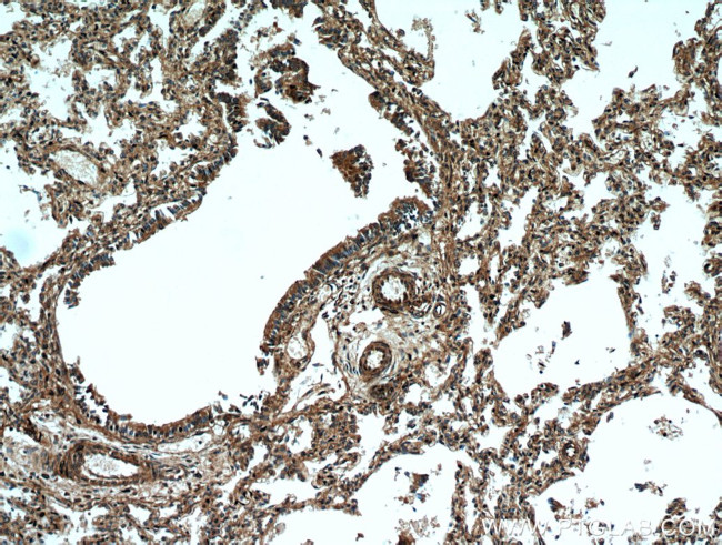 UBAP1 Antibody in Immunohistochemistry (Paraffin) (IHC (P))