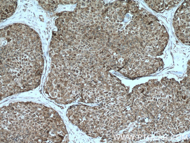 UBAP1 Antibody in Immunohistochemistry (Paraffin) (IHC (P))