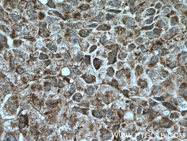 UBAP1 Antibody in Immunohistochemistry (Paraffin) (IHC (P))