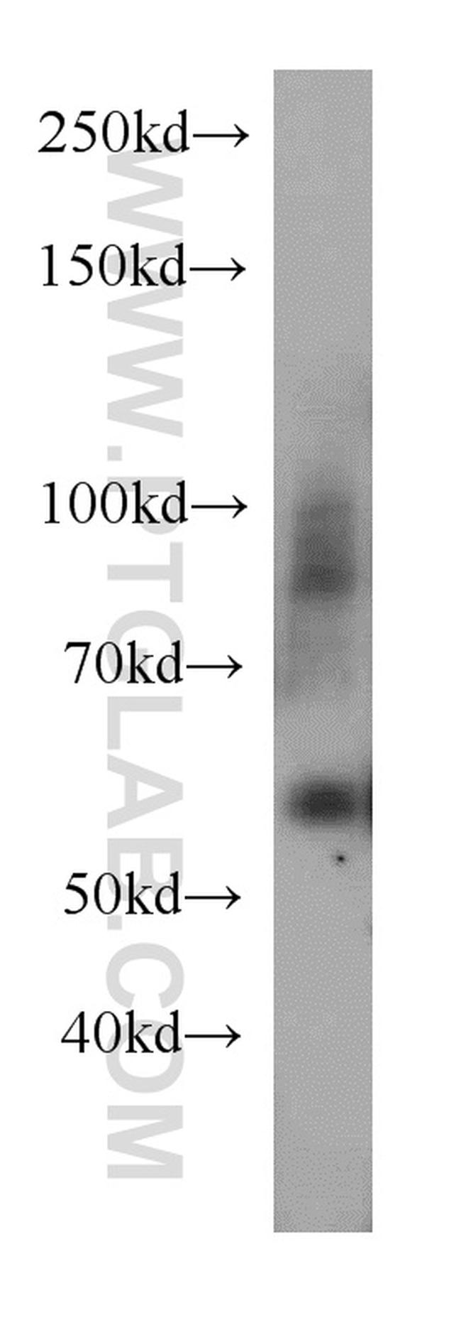 UBAP1 Antibody in Western Blot (WB)