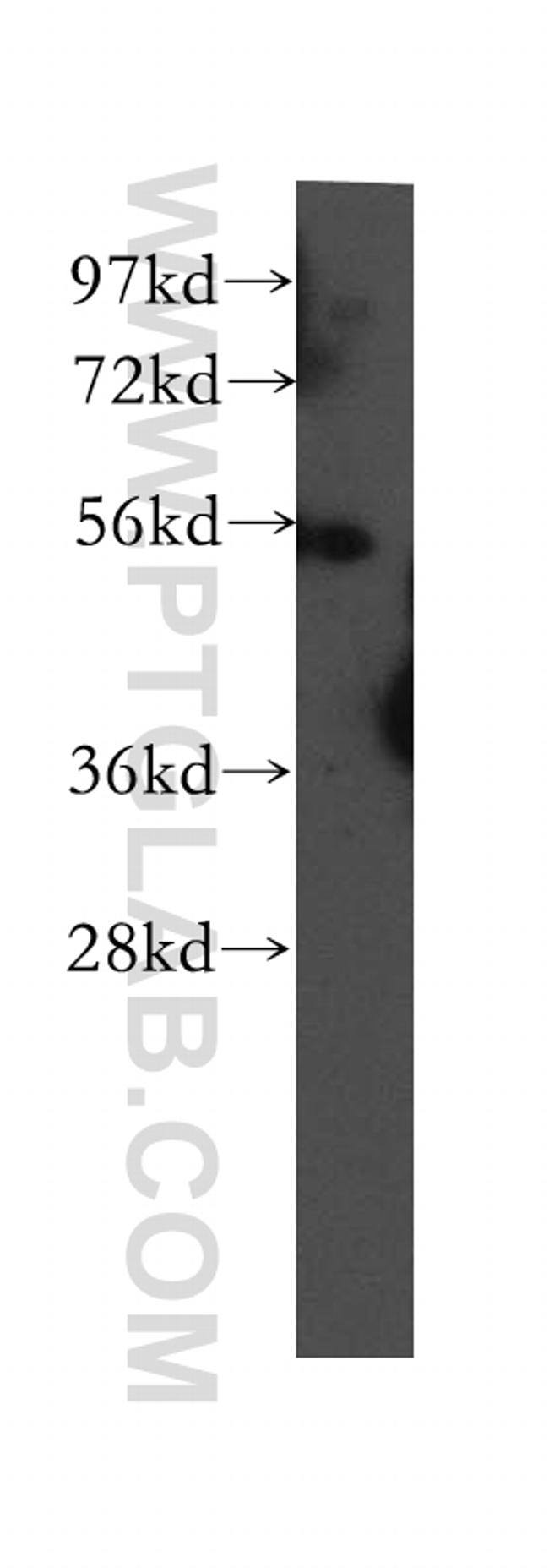 UBAP1 Antibody in Western Blot (WB)