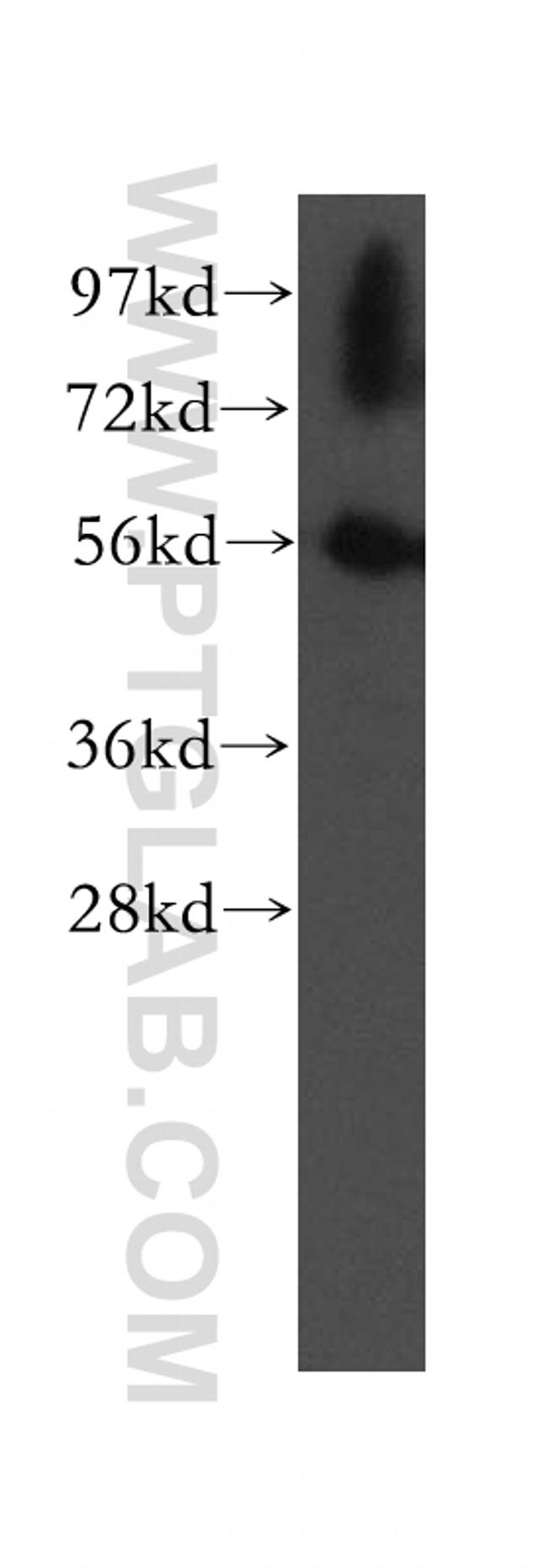 UBAP1 Antibody in Western Blot (WB)