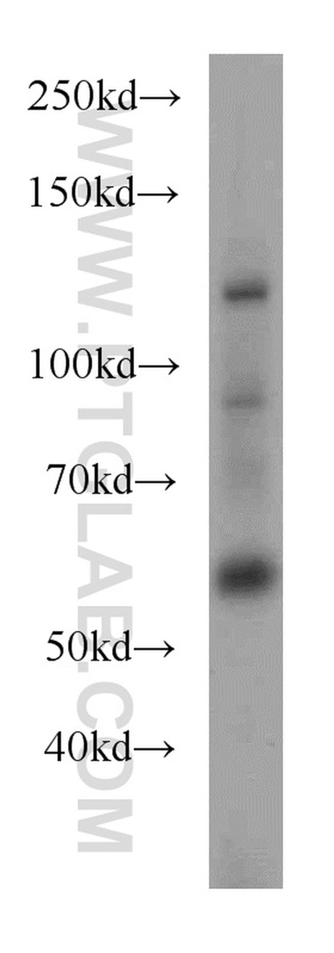 UBAP1 Antibody in Western Blot (WB)