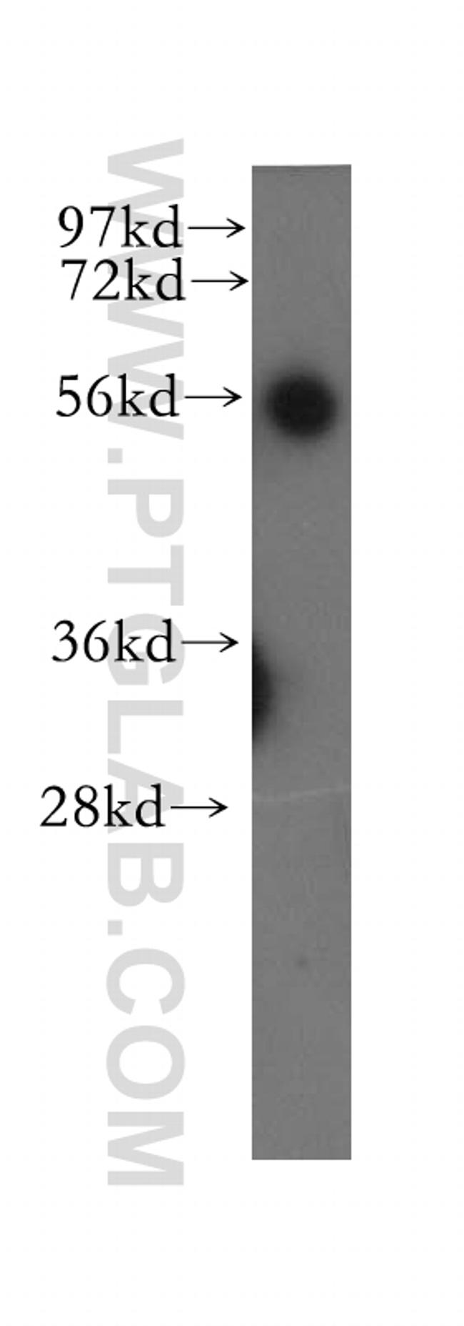 UBAP1 Antibody in Western Blot (WB)