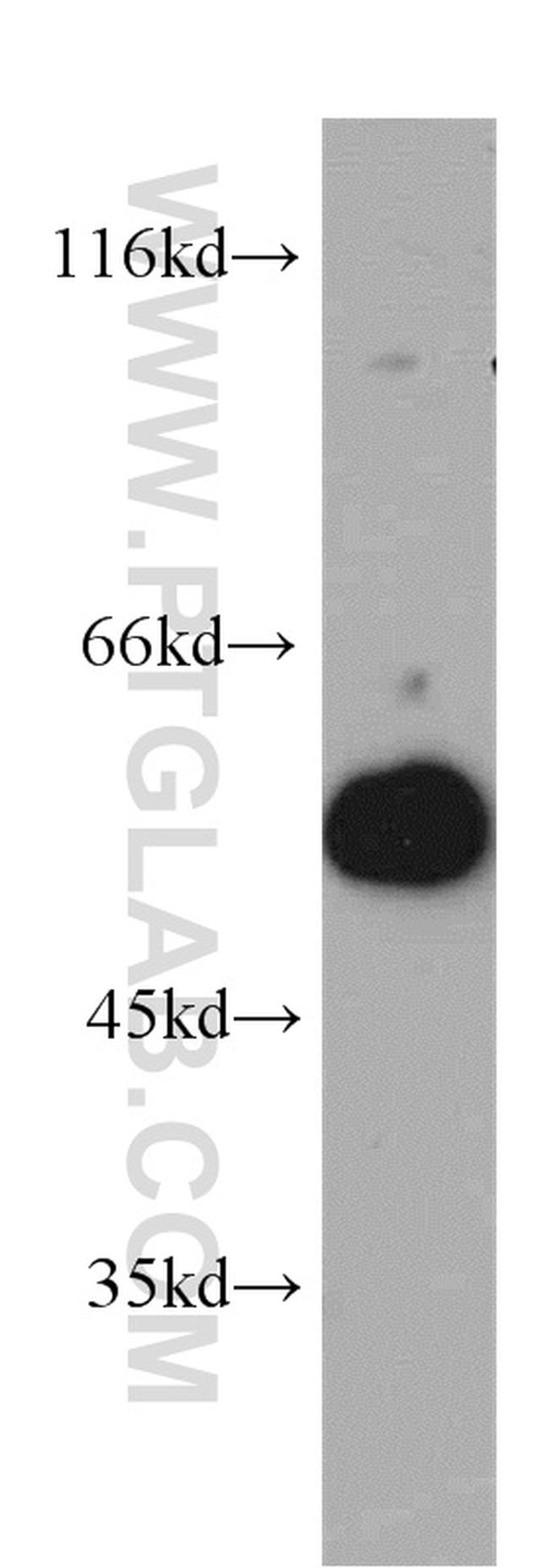 UBAP1 Antibody in Western Blot (WB)