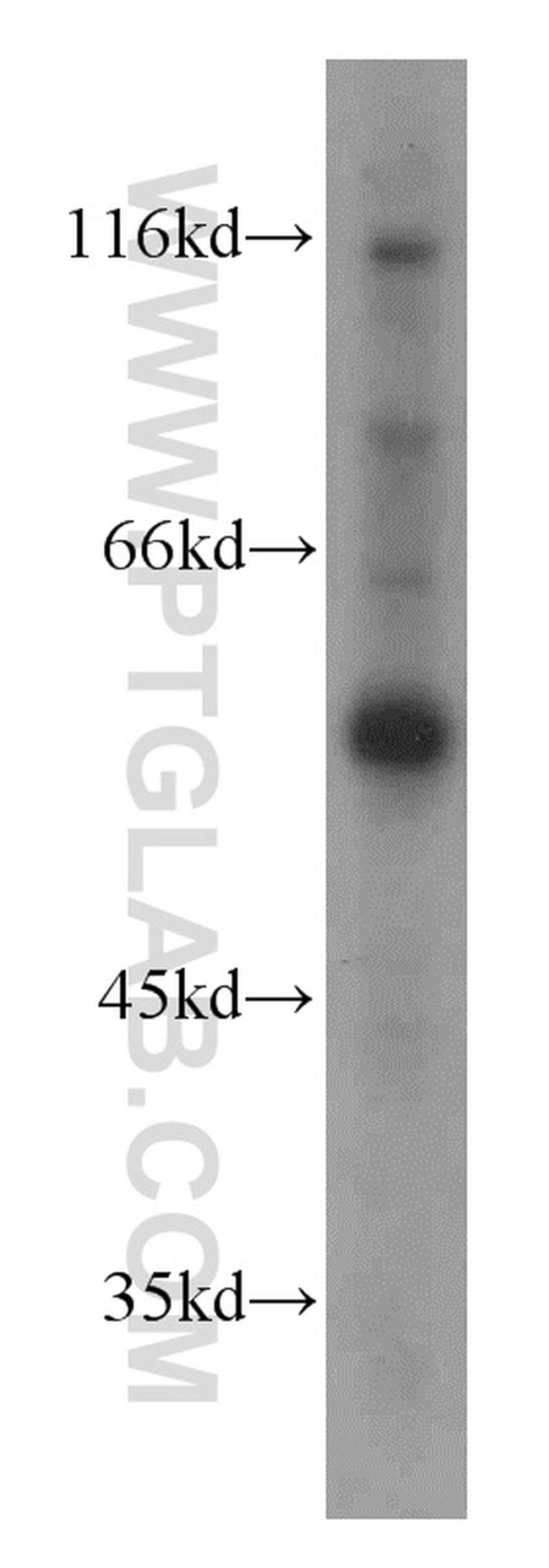 UBAP1 Antibody in Western Blot (WB)