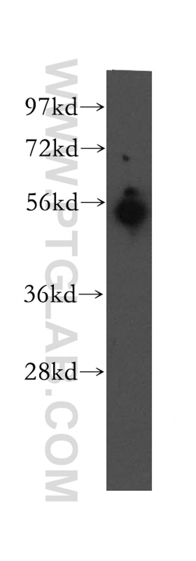 UBAP1 Antibody in Western Blot (WB)