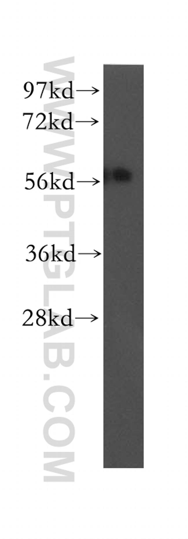 UBAP1 Antibody in Western Blot (WB)