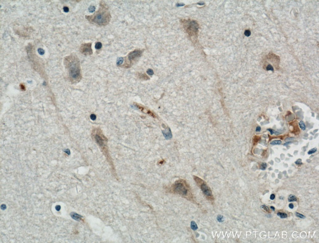 RGMA Antibody in Immunohistochemistry (Paraffin) (IHC (P))