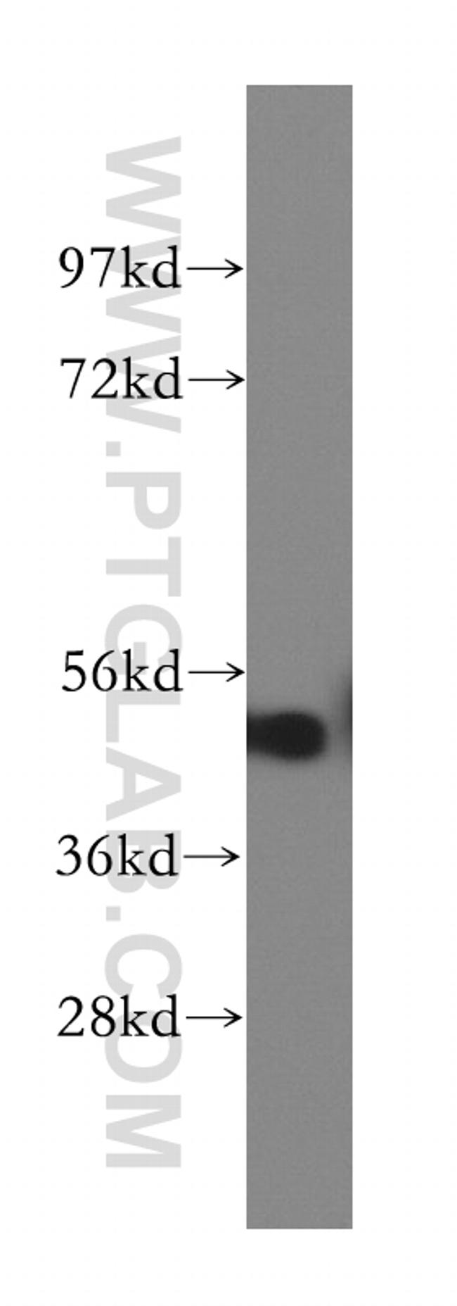 RGMA Antibody in Western Blot (WB)