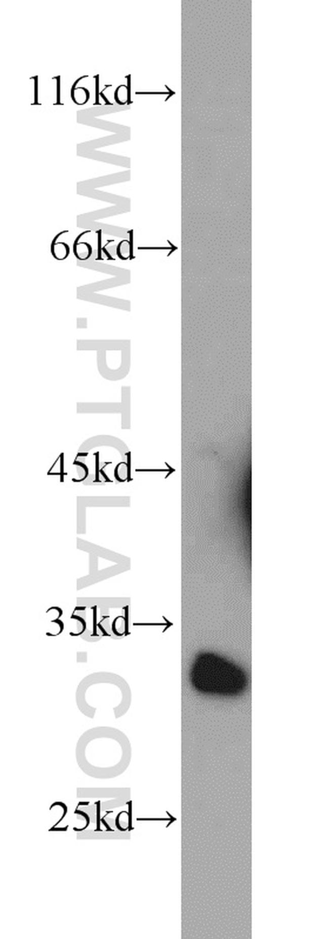 CA8 Antibody in Western Blot (WB)