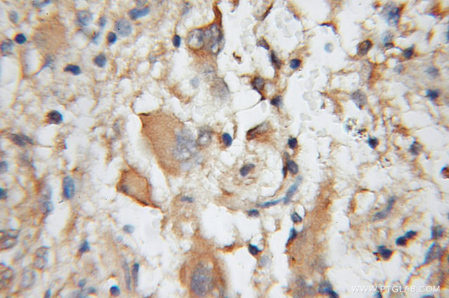 CA8 Antibody in Immunohistochemistry (Paraffin) (IHC (P))