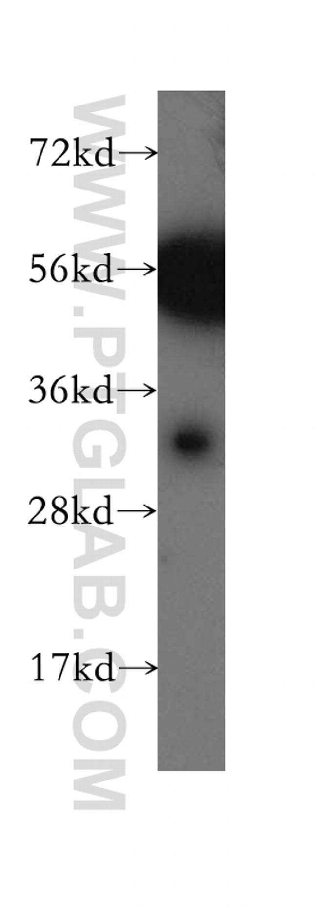 CA8 Antibody in Western Blot (WB)