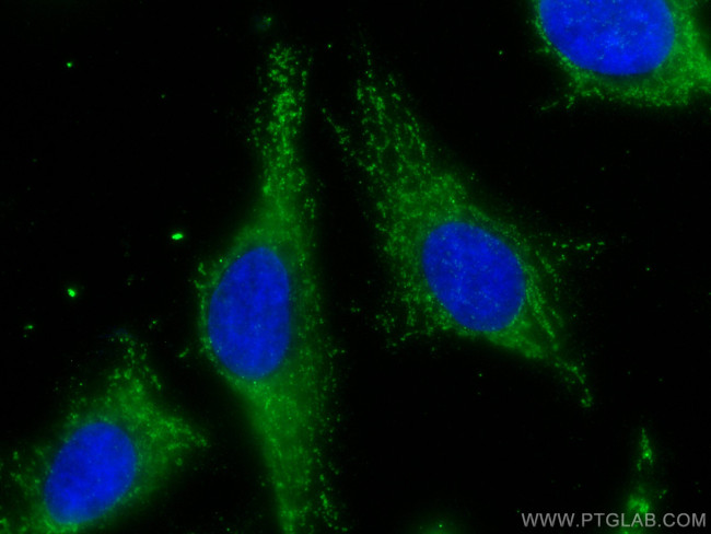 A4GALT Antibody in Immunocytochemistry (ICC/IF)