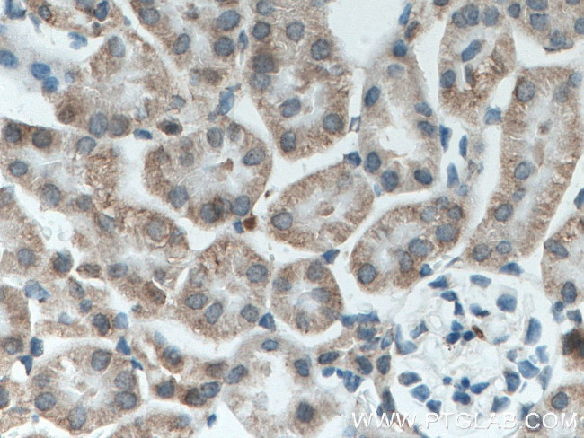 A4GALT Antibody in Immunohistochemistry (Paraffin) (IHC (P))