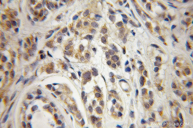 COPG Antibody in Immunohistochemistry (Paraffin) (IHC (P))