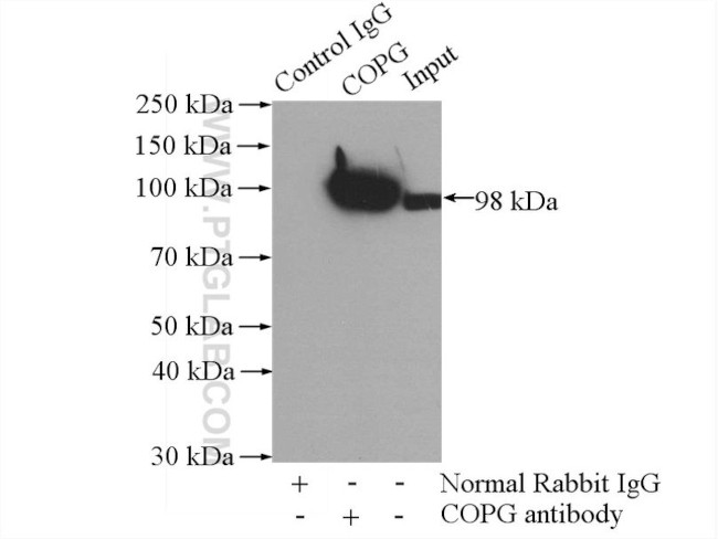 COPG Antibody in Immunoprecipitation (IP)