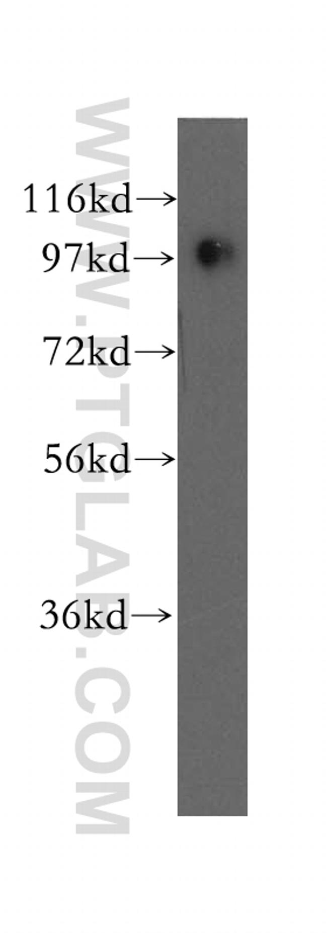 COPG Antibody in Western Blot (WB)