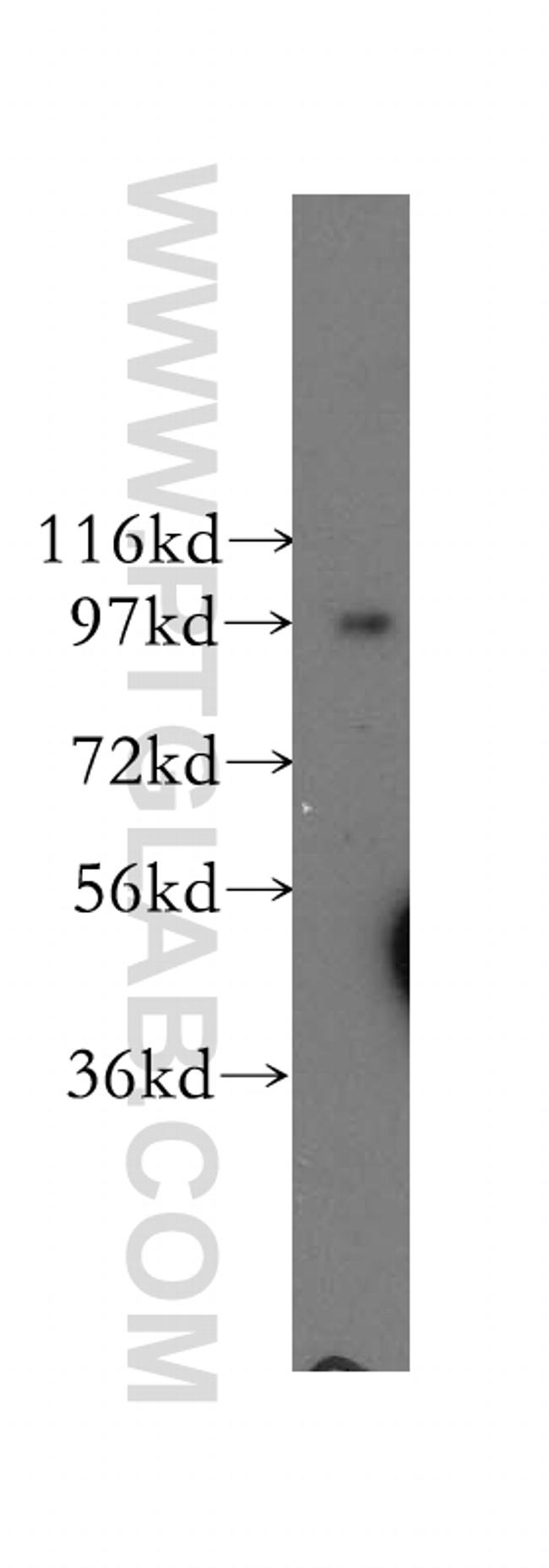 COPG Antibody in Western Blot (WB)