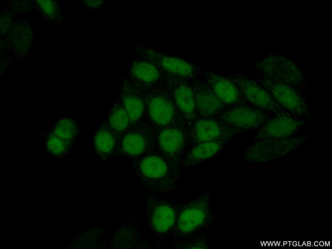 UNG Antibody in Immunocytochemistry (ICC/IF)