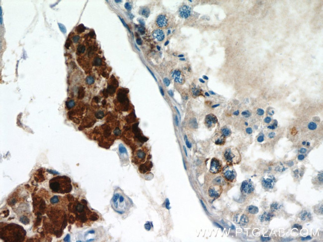 UNG Antibody in Immunohistochemistry (Paraffin) (IHC (P))